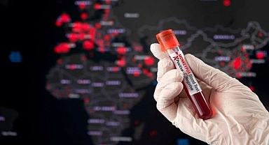 Acil durum ilan edilmişti! Salgın durdurulamıyor