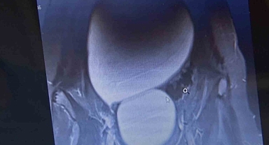 Doktorlar bile gözlerine inanamadı